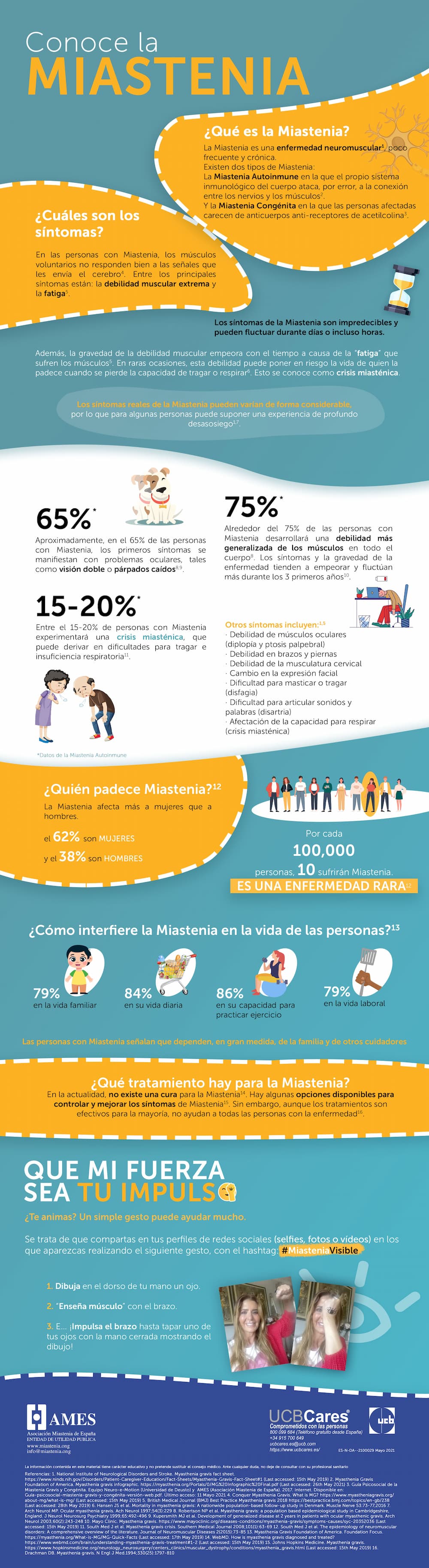 miastenia